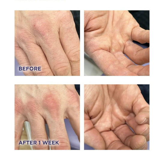 Footlogix Hydrating Hand Mousse 125ml