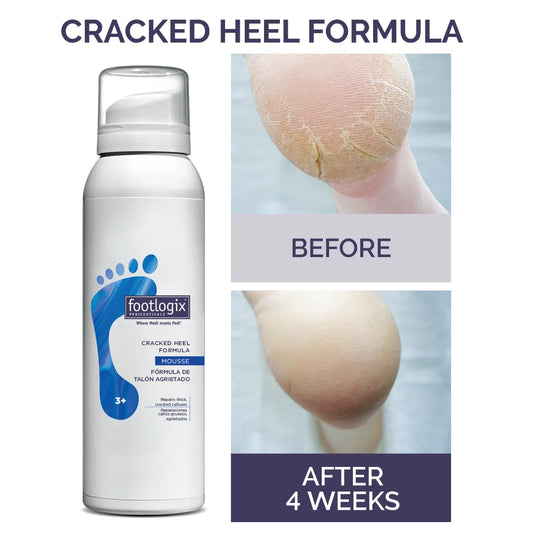 Footlogix Cracked Heel Formula 125ml